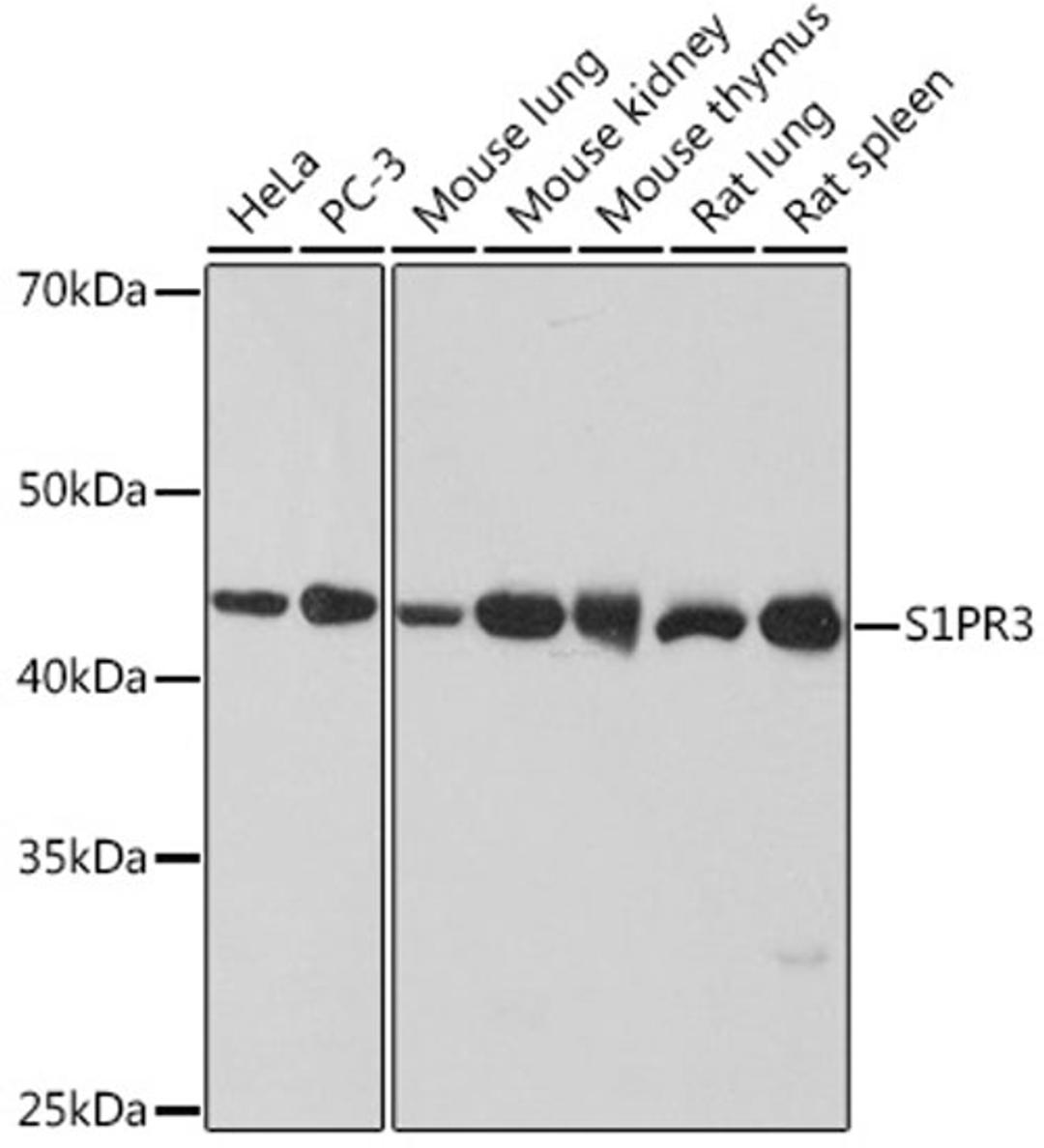 Western blot - S1PR3 Rabbit mAb (A1404)