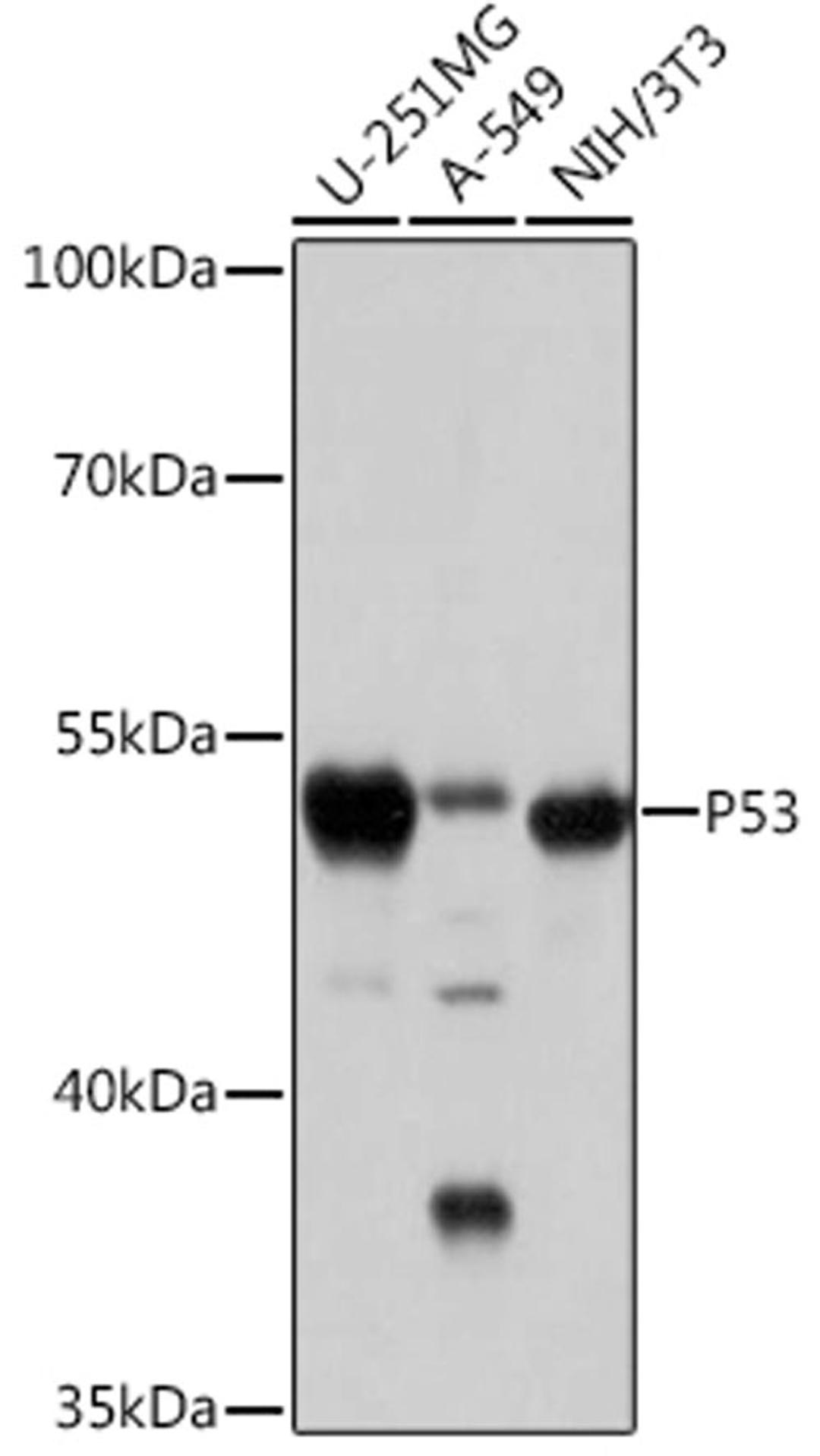 Western blot - p53 antibody (A16989)