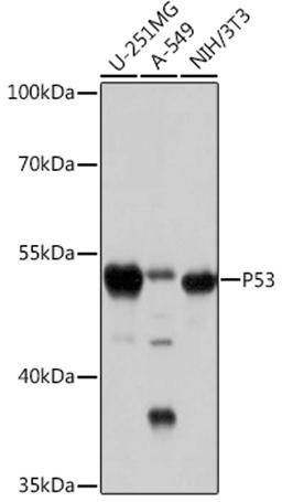 Western blot - p53 antibody (A16989)