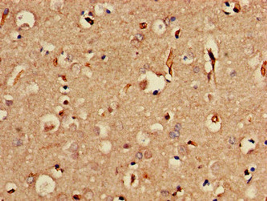 Immunohistochemistry of paraffin-embedded human brain tissue using CSB-PA822282LA01HU at dilution of 1:100