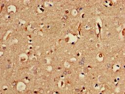 Immunohistochemistry of paraffin-embedded human brain tissue using CSB-PA822282LA01HU at dilution of 1:100