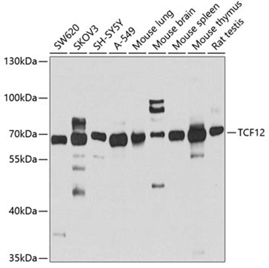 Western blot - TCF12 antibody (A4146)