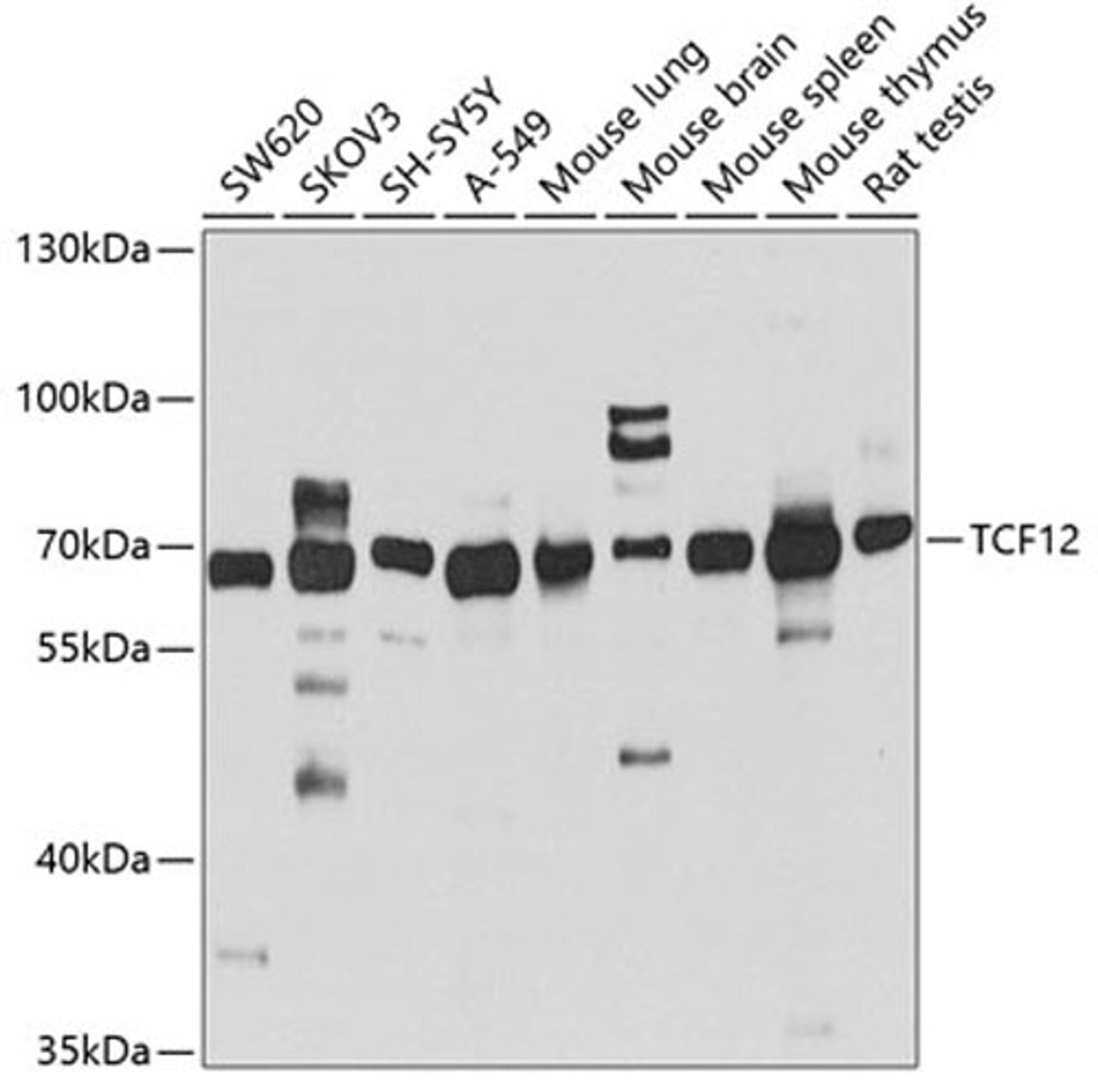 Western blot - TCF12 antibody (A4146)