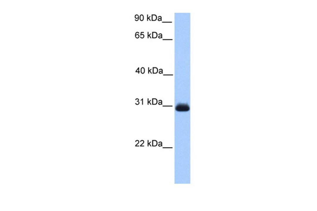 Antibody used in WB on Human Liver at 0.2-1 ug/ml.