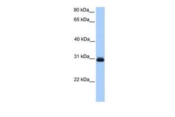 Antibody used in WB on Human Liver at 0.2-1 ug/ml.