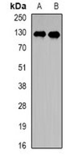 Western blot analysis of HepG2 (Lane1), Jurkat (Lane2) whole cell lysates using PPP6R2 antibody