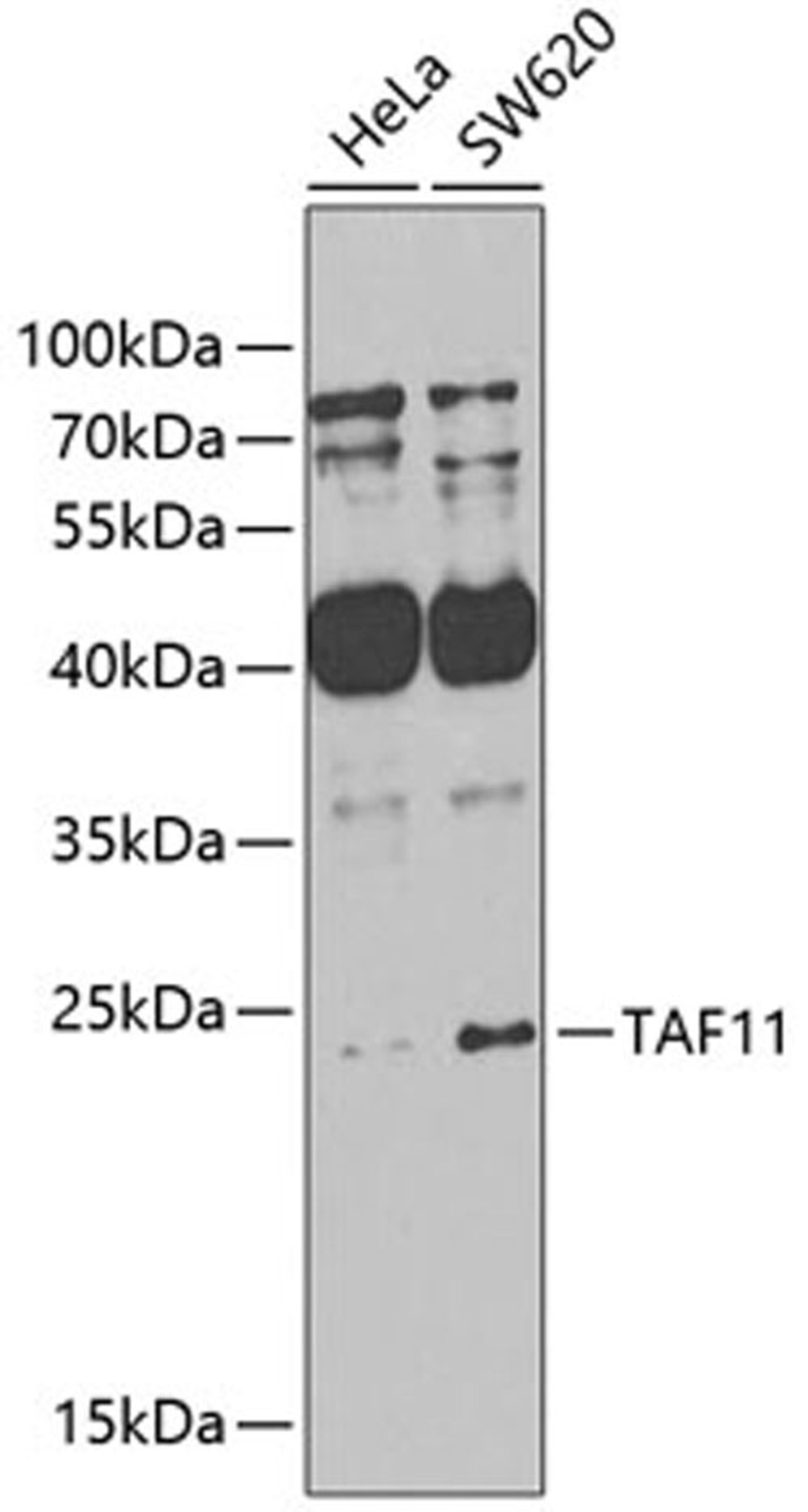 Western blot - TAF11 antibody (A7934)