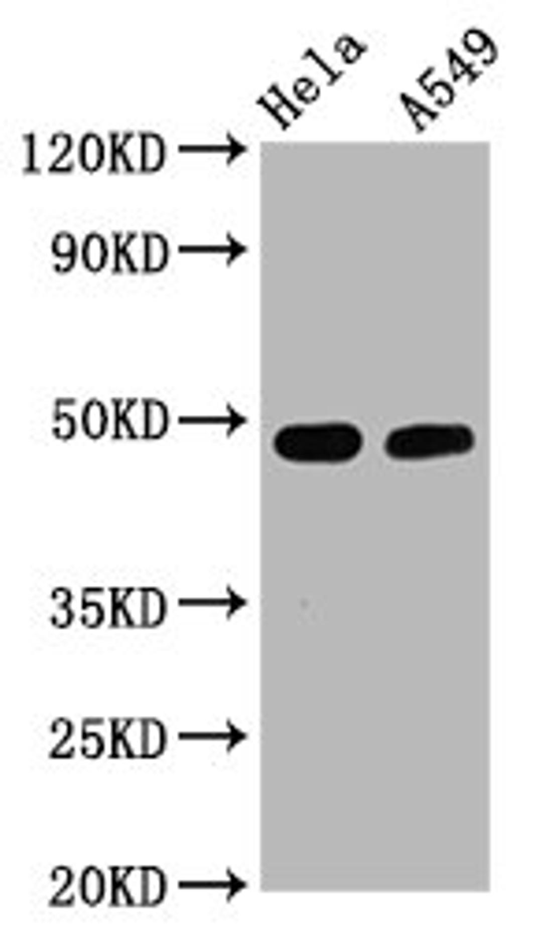 Western Blot. Positive WB detected in Hela whole cell lysate,A549 whole cell lysate. All lanes Phospho-GATA3 antibody at 2.5μg/ml. Secondary. Goat polyclonal to rabbit IgG at 1/50000 dilution. Predicted band size: 48 KDa. Observed band size: 48 KDa.