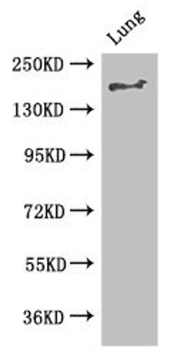 Western Blot. Positive WB detected in: Mouse lung tissue. All lanes: TSC2 antibody at 2.8ug/ml. Secondary. Goat polyclonal to rabbit IgG at 1/50000 dilution. Predicted band size: 201, 196, 199, 194, 190, 188, 26 kDa. Observed band size: 201 kDa.