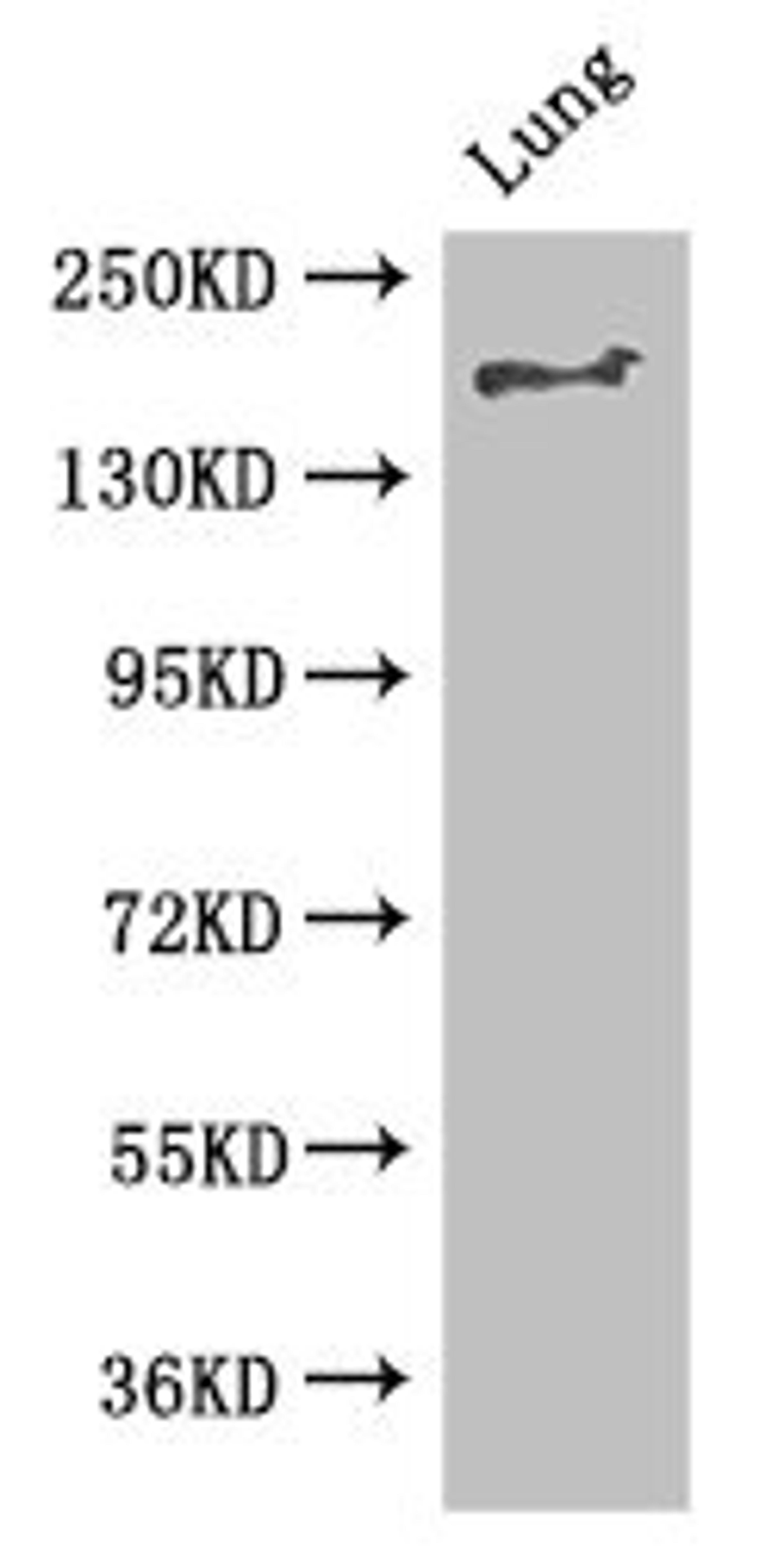 Western Blot. Positive WB detected in: Mouse lung tissue. All lanes: TSC2 antibody at 2.8ug/ml. Secondary. Goat polyclonal to rabbit IgG at 1/50000 dilution. Predicted band size: 201, 196, 199, 194, 190, 188, 26 kDa. Observed band size: 201 kDa.