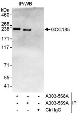 Detection of human GCC185 by western blot of immunoprecipitates.