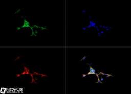 Immunocytochemistry/Immunofluorescence: Sonic Hedgehog Antibody [NBP2-22139] - Sonic Hedgehog antibody was tested in SH-SY5Y cells with FITC (green). Nuclei and alpha-tubulin were counterstained with DAPI (blue) and Dylight 550 (red).