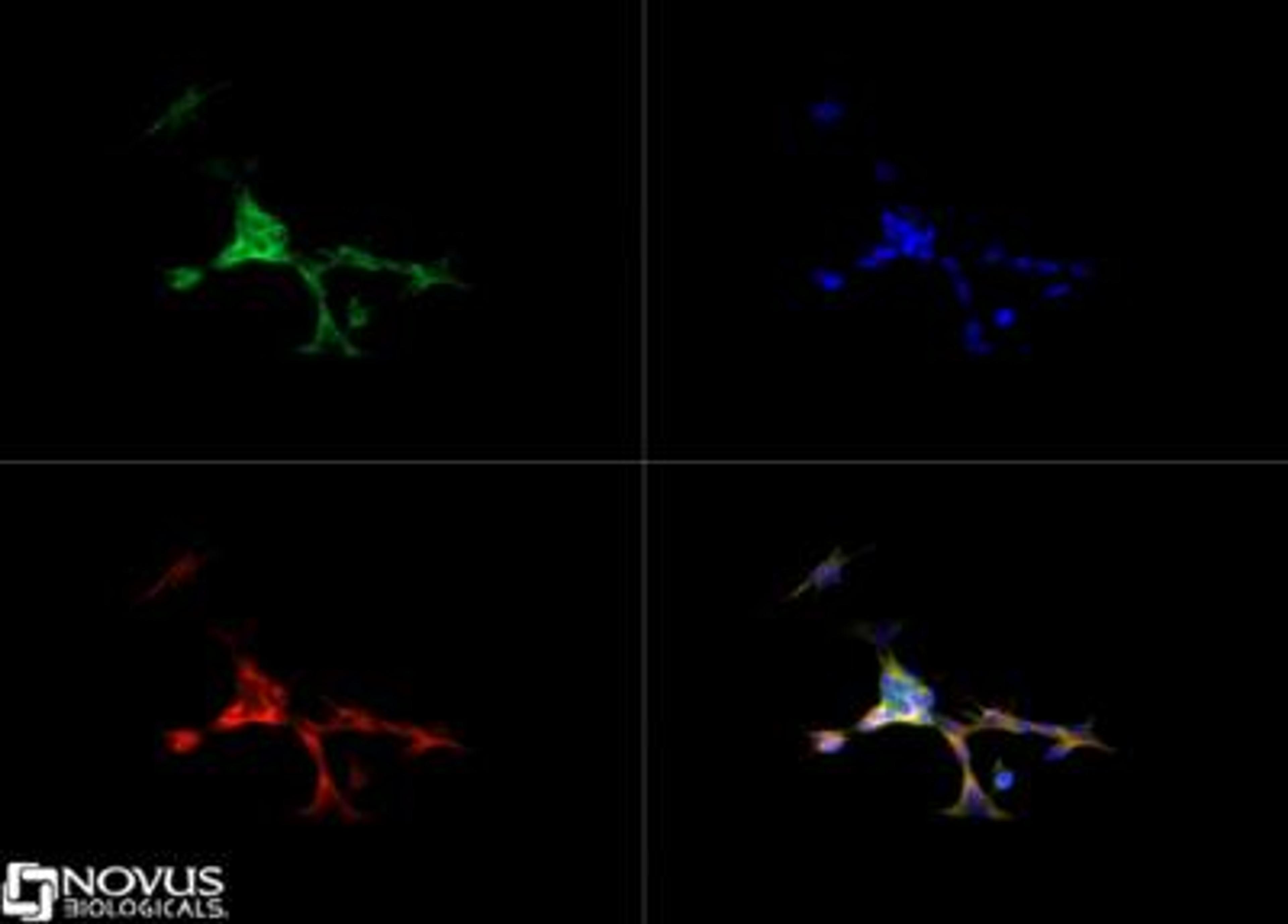 Immunocytochemistry/Immunofluorescence: Sonic Hedgehog Antibody [NBP2-22139] - Sonic Hedgehog antibody was tested in SH-SY5Y cells with FITC (green). Nuclei and alpha-tubulin were counterstained with DAPI (blue) and Dylight 550 (red).