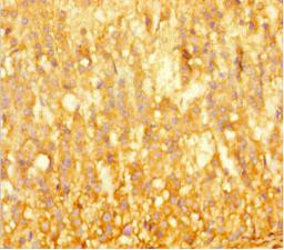 Immunohistochemistry of paraffin-embedded human adrenal gland tissue using CSB-PA624013HA01HU at dilution of 1:100