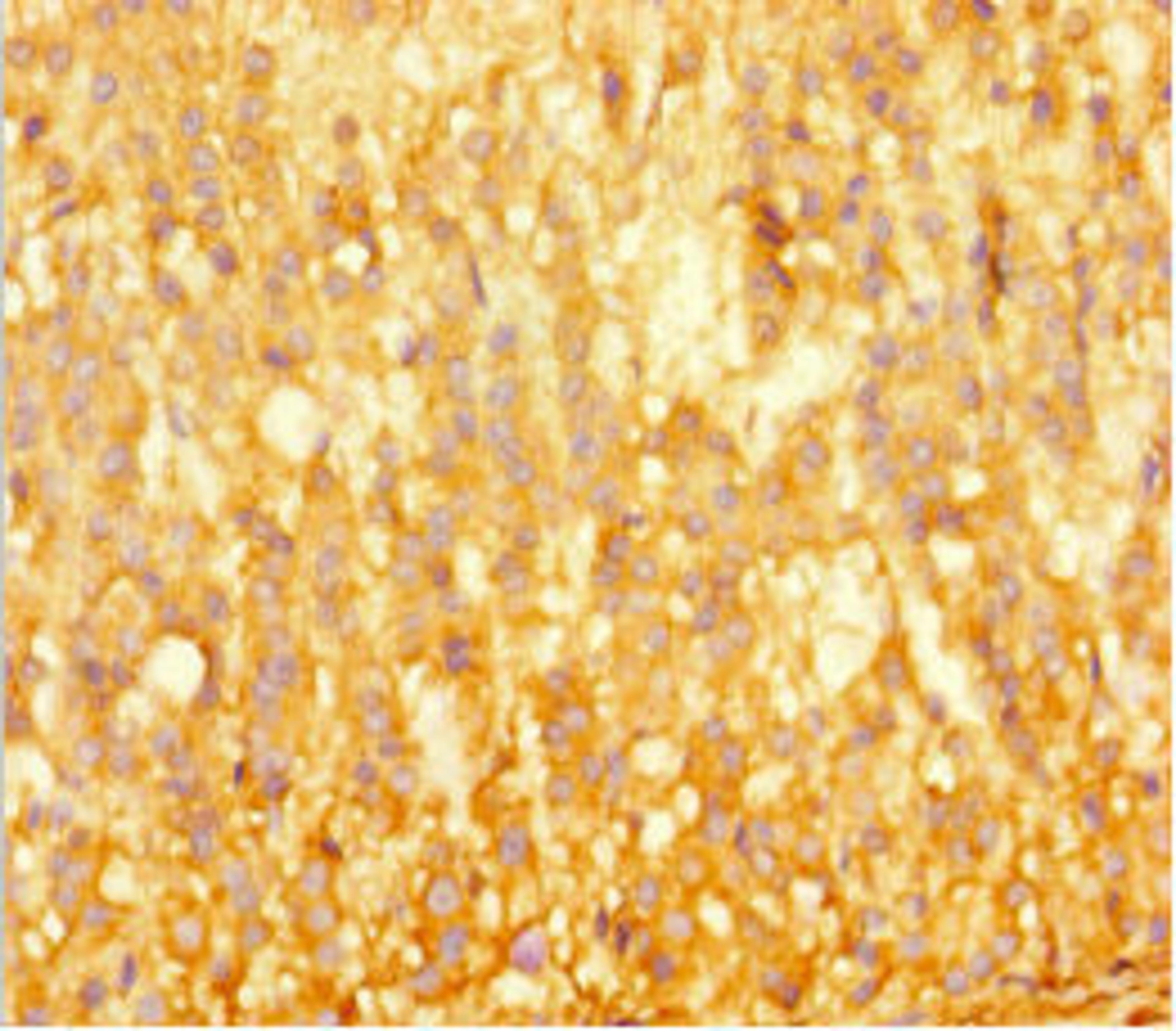 Immunohistochemistry of paraffin-embedded human adrenal gland tissue using CSB-PA624013HA01HU at dilution of 1:100