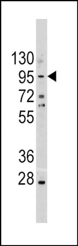 Western blot analysis of CDH1 Antibody in A375 cell line lysates (35ug/lane)