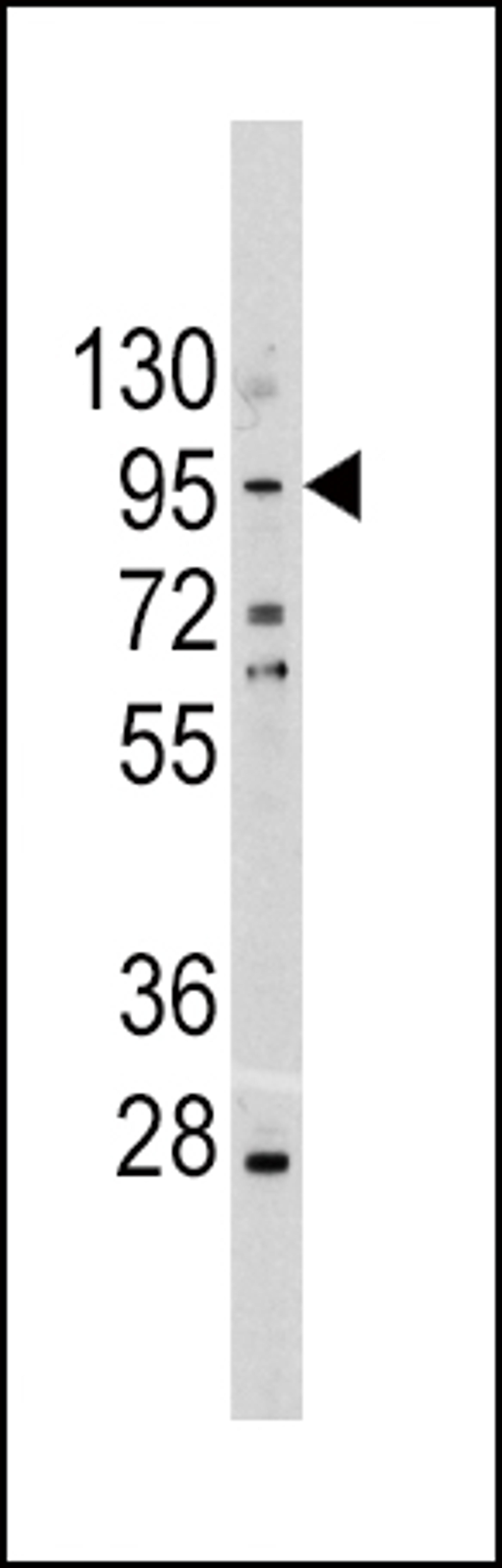 Western blot analysis of CDH1 Antibody in A375 cell line lysates (35ug/lane)