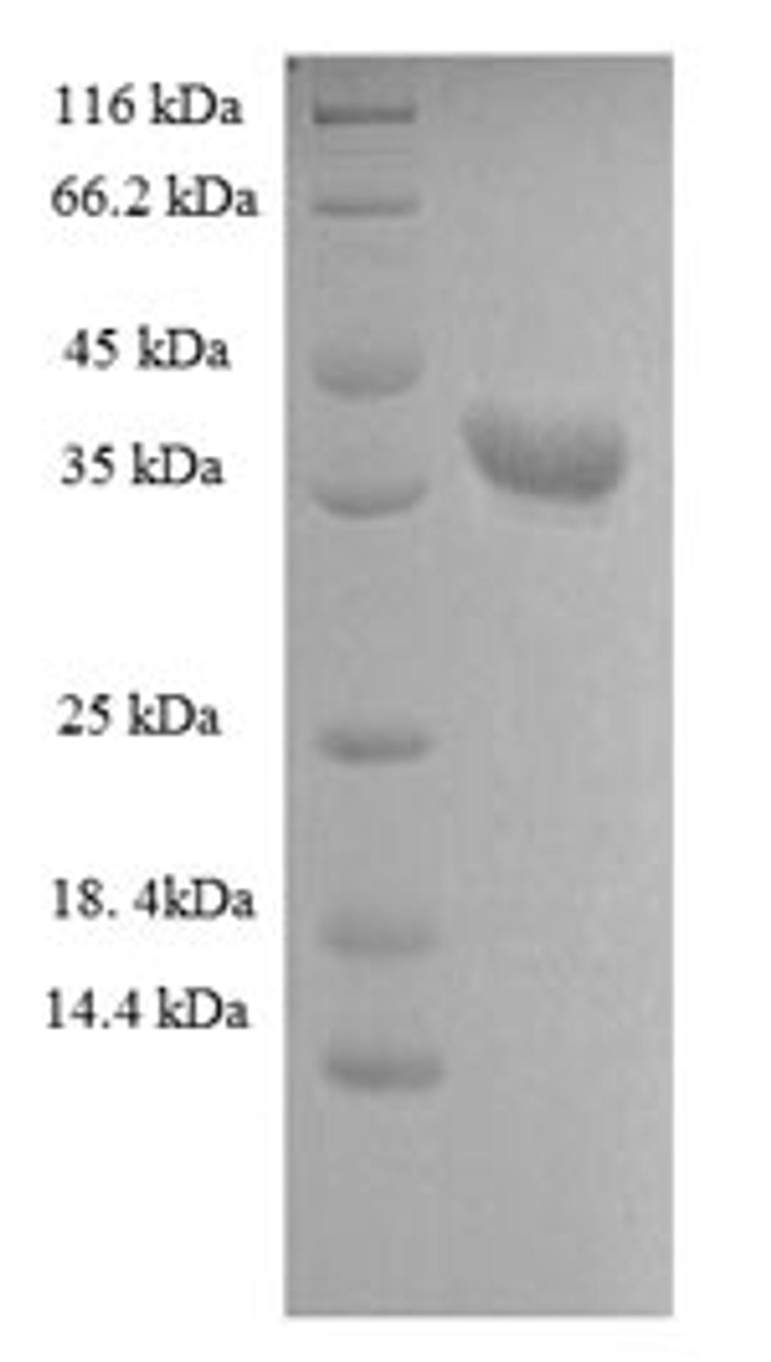 (Tris-Glycine gel) Discontinuous SDS-PAGE (reduced) with 5% enrichment gel and 15% separation gel.
