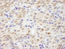 Detection of human XLF by immunohistochemistry.