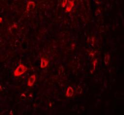 Immunocytochemistry/Immunofluorescence: ZBTB3 Antibody [NBP1-76516] - Immunofluorescence of ZBTB3 in human brain tissue with ZBTB3 antibody at 20 ug/mL.