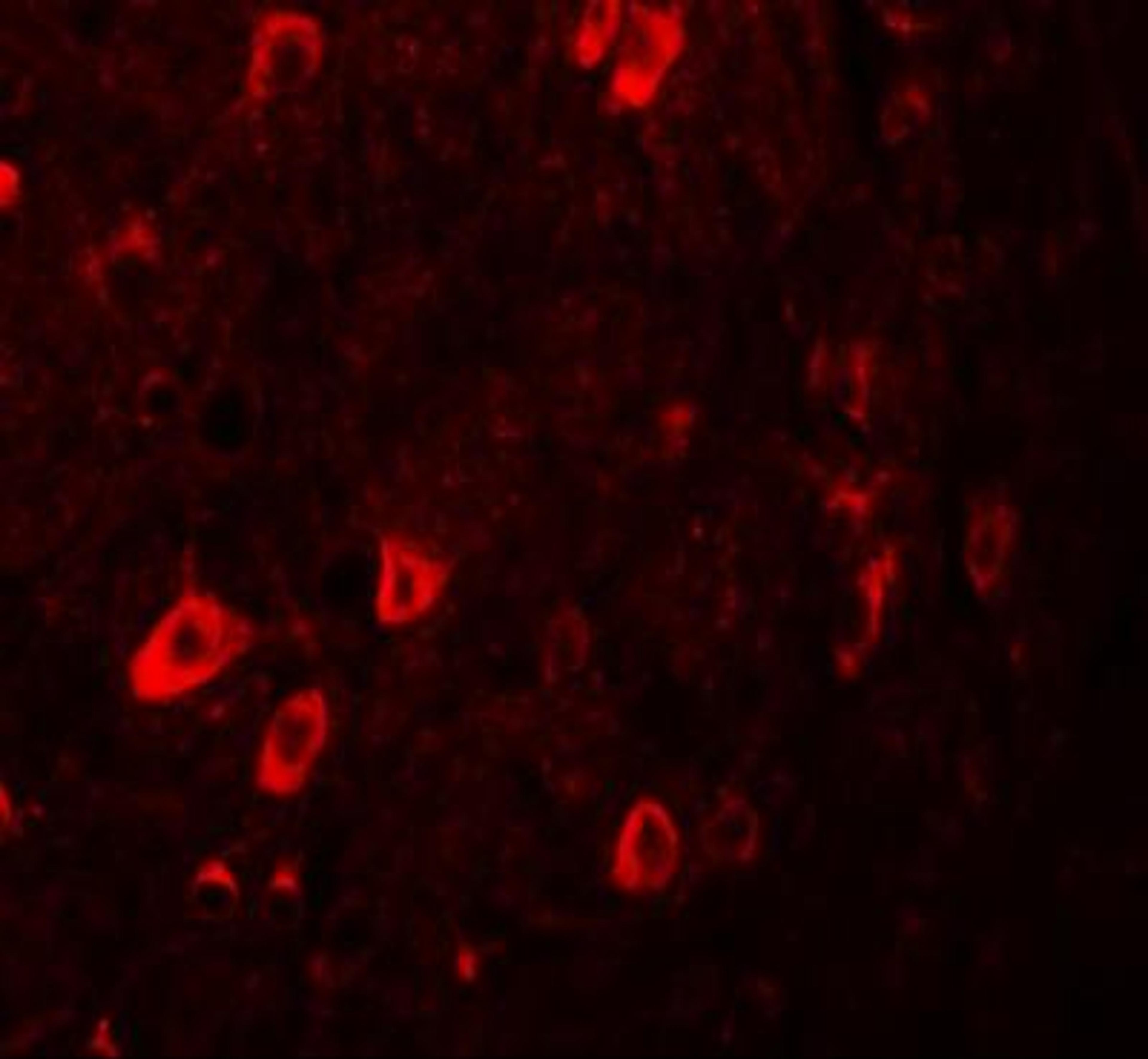 Immunocytochemistry/Immunofluorescence: ZBTB3 Antibody [NBP1-76516] - Immunofluorescence of ZBTB3 in human brain tissue with ZBTB3 antibody at 20 ug/mL.