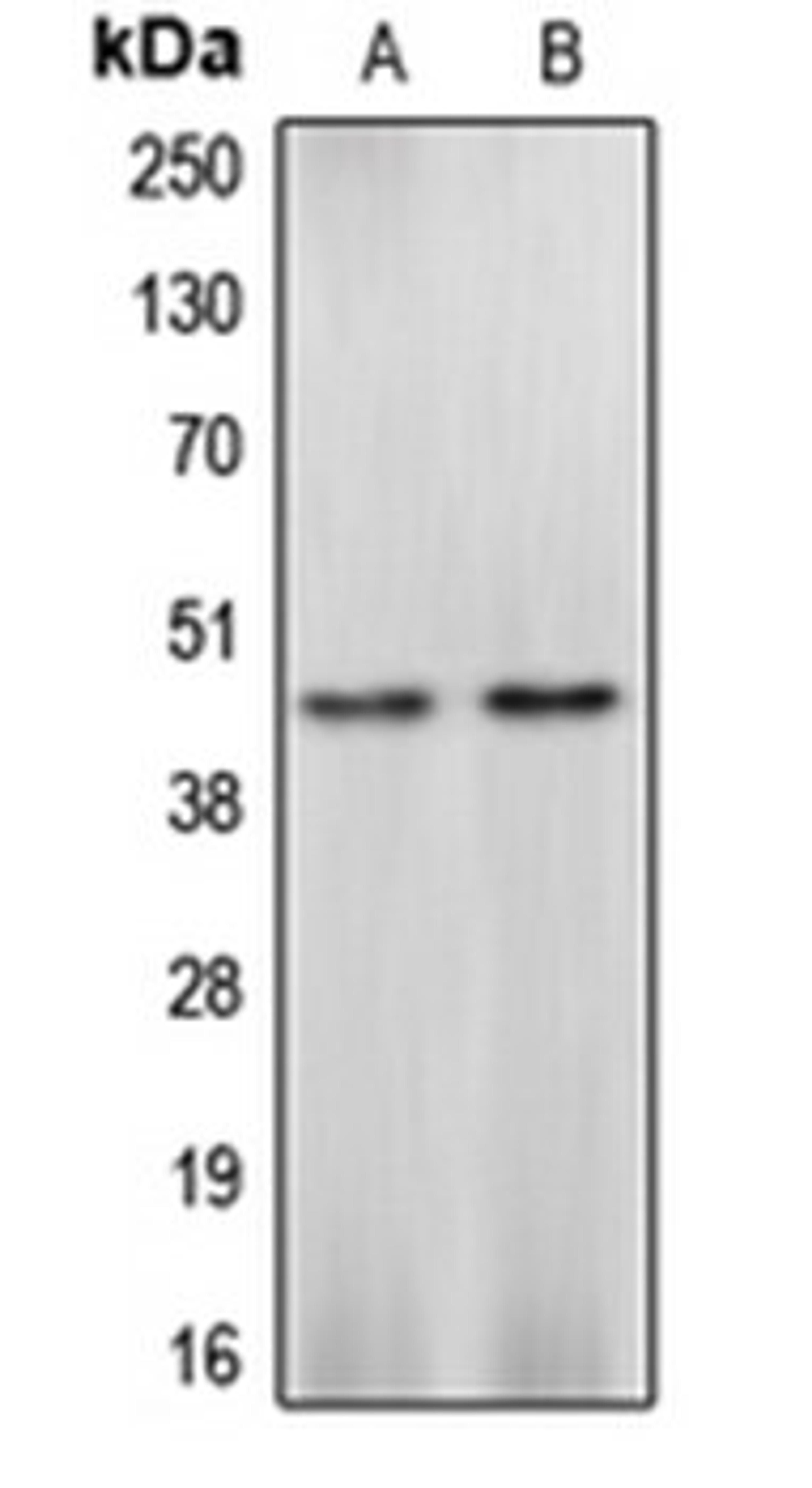 Western blot analysis of Ramos (Lane 1), HEK293 (Lane 2) whole cell lysates using CASP4 antibody