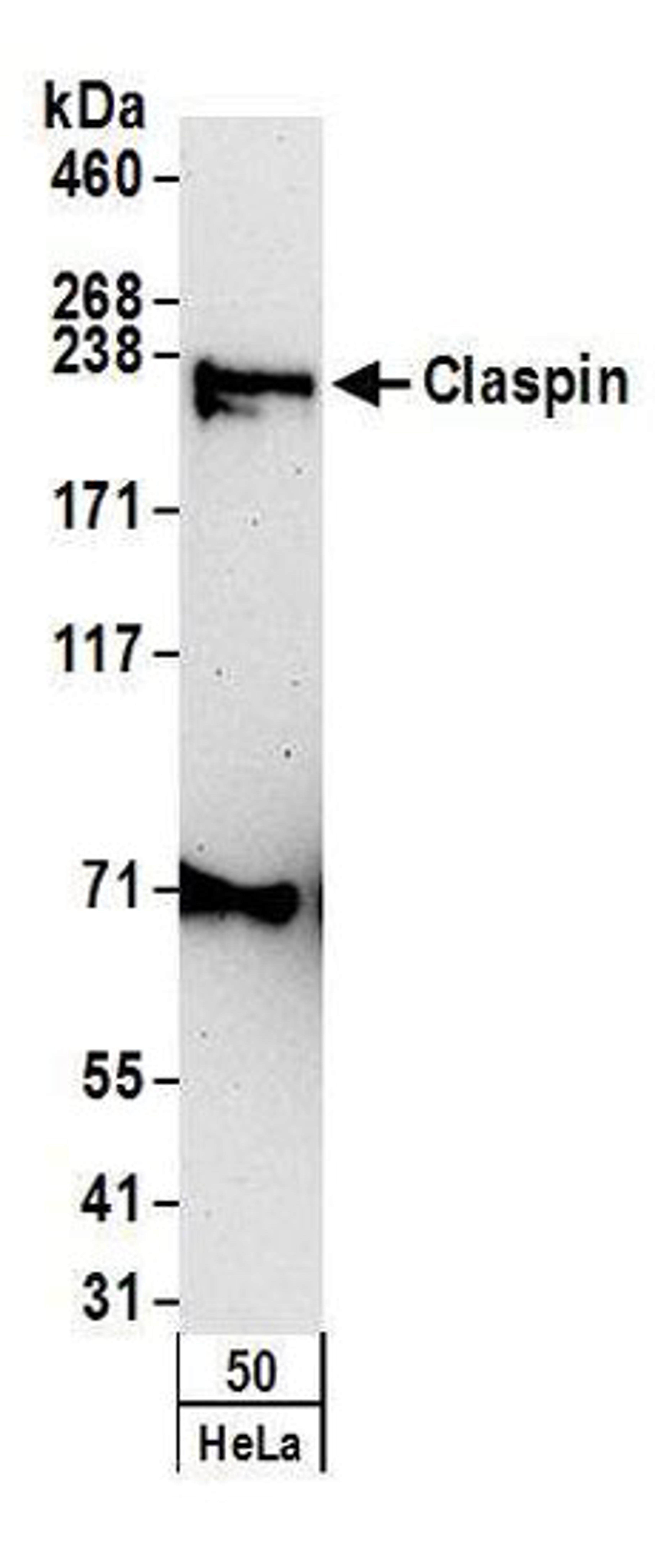 Detection of human Claspin by western blot.