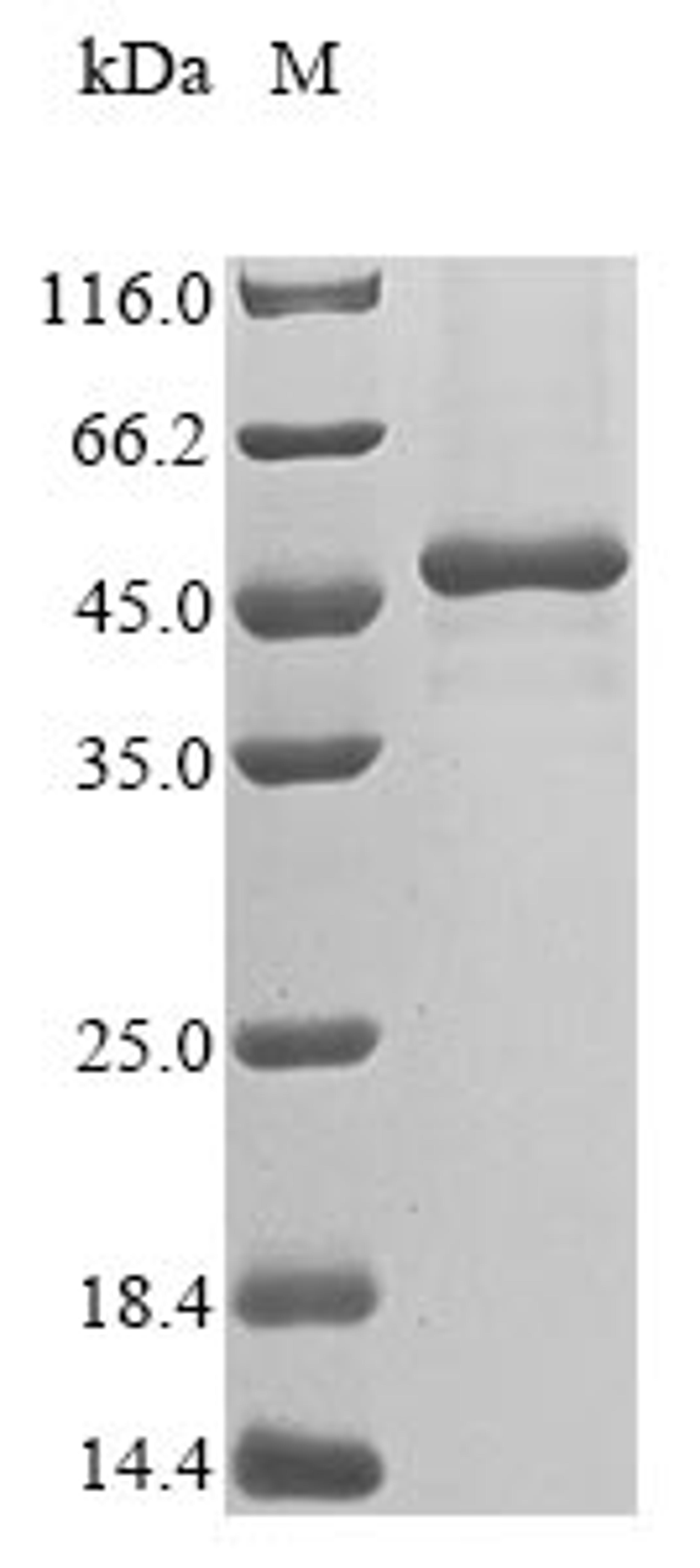 (Tris-Glycine gel) Discontinuous SDS-PAGE (reduced) with 5% enrichment gel and 15% separation gel.