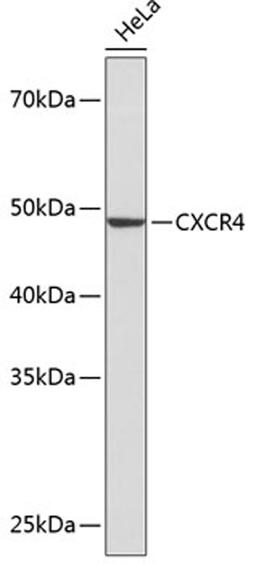 Western blot - CXCR4 antibody (A19035)