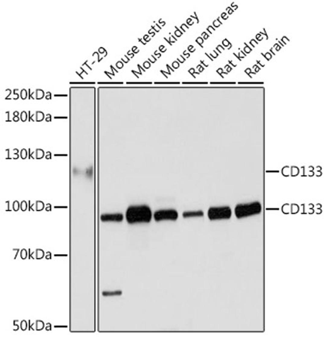 Western blot - CD133 antibody (A0219)