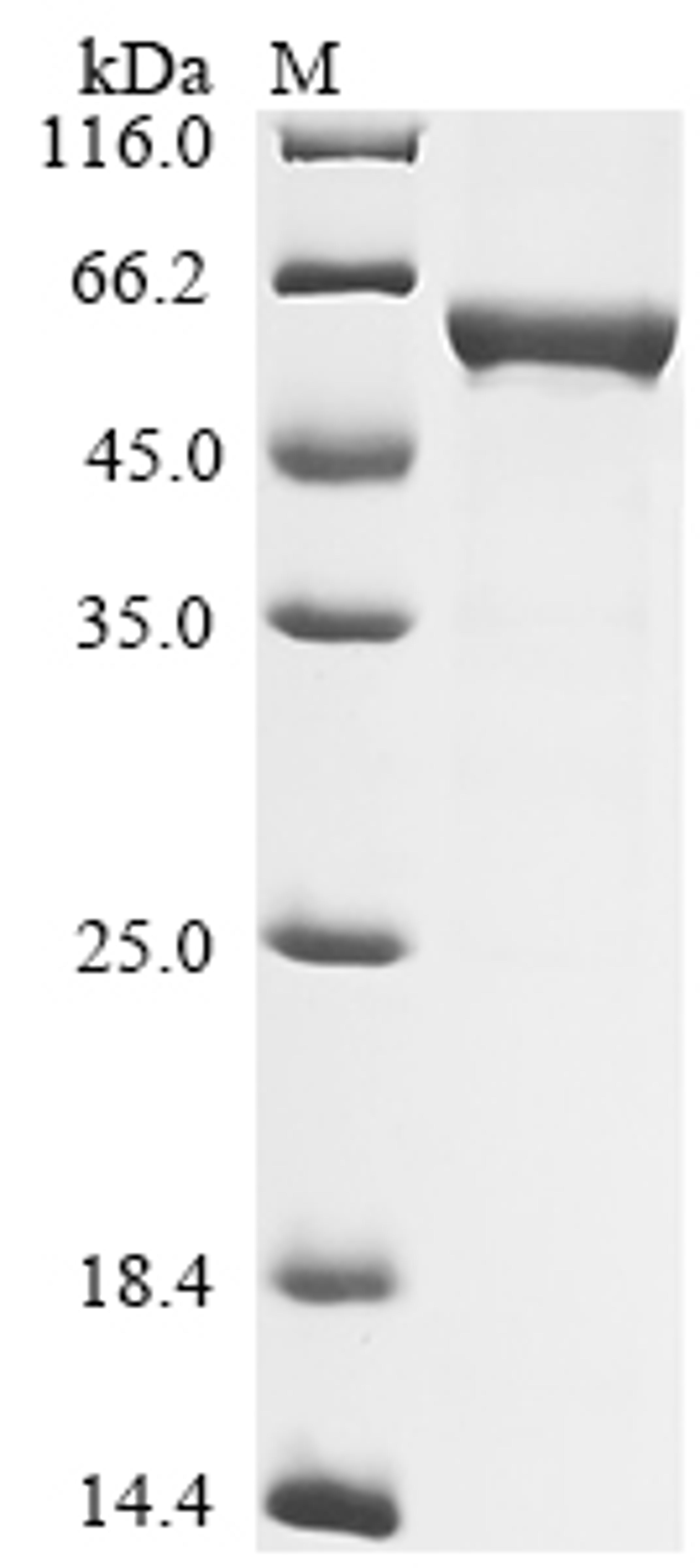 (Tris-Glycine gel) Discontinuous SDS-PAGE (reduced) with 5% enrichment gel and 15% separation gel.