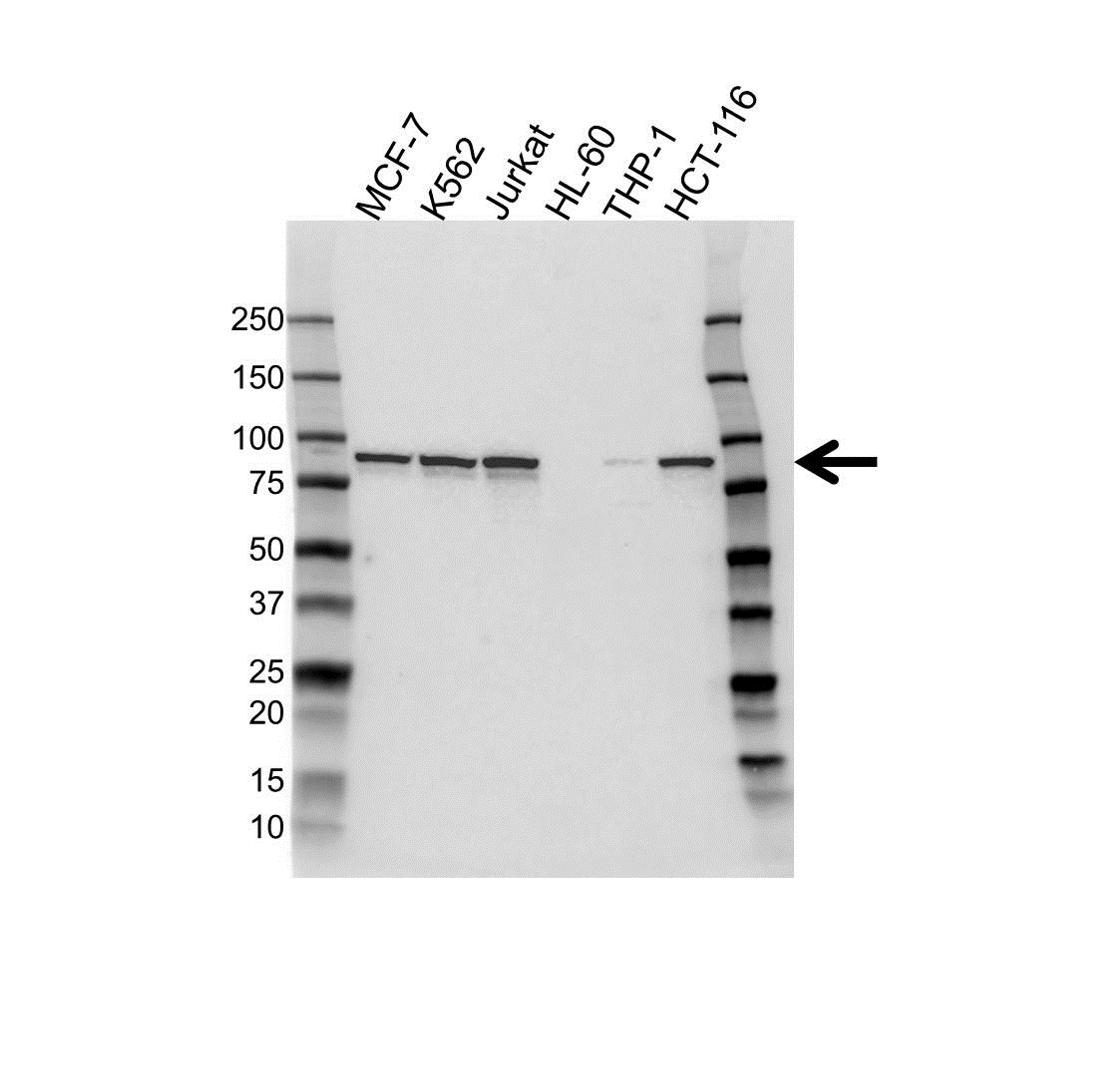 Western blot analysis of whole cell lysates probed with IKK antibody