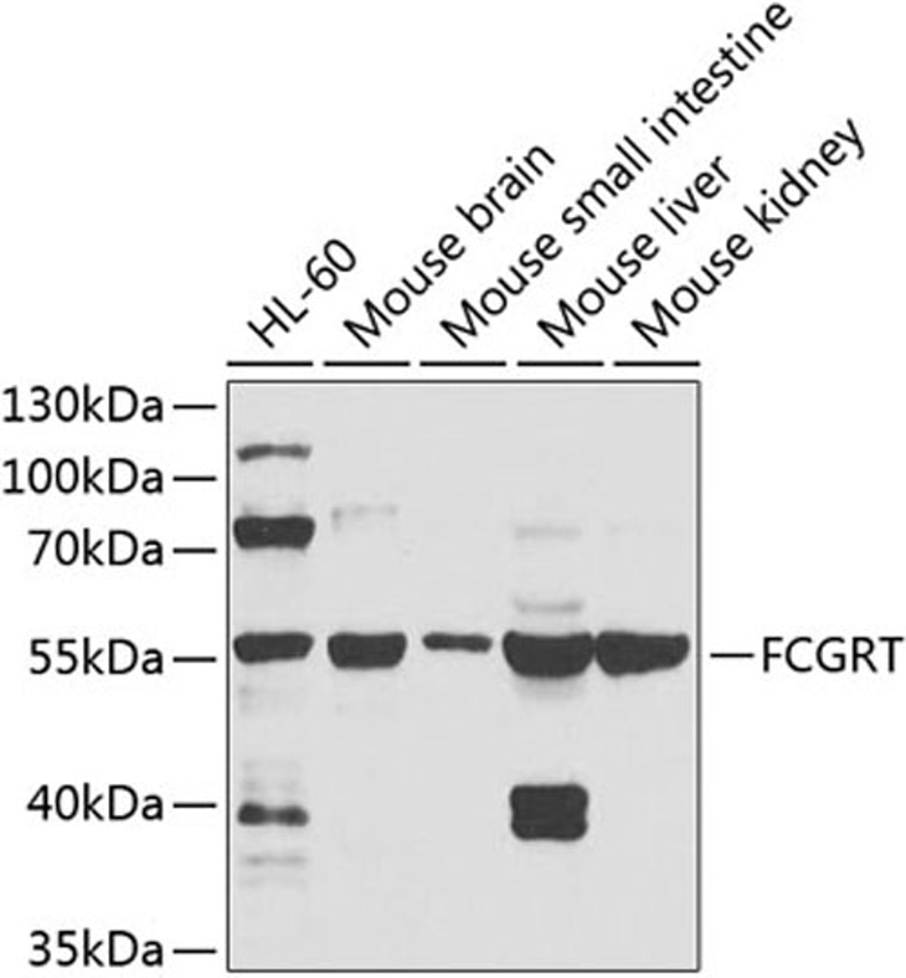 Western blot - FCGRT antibody (A8544)