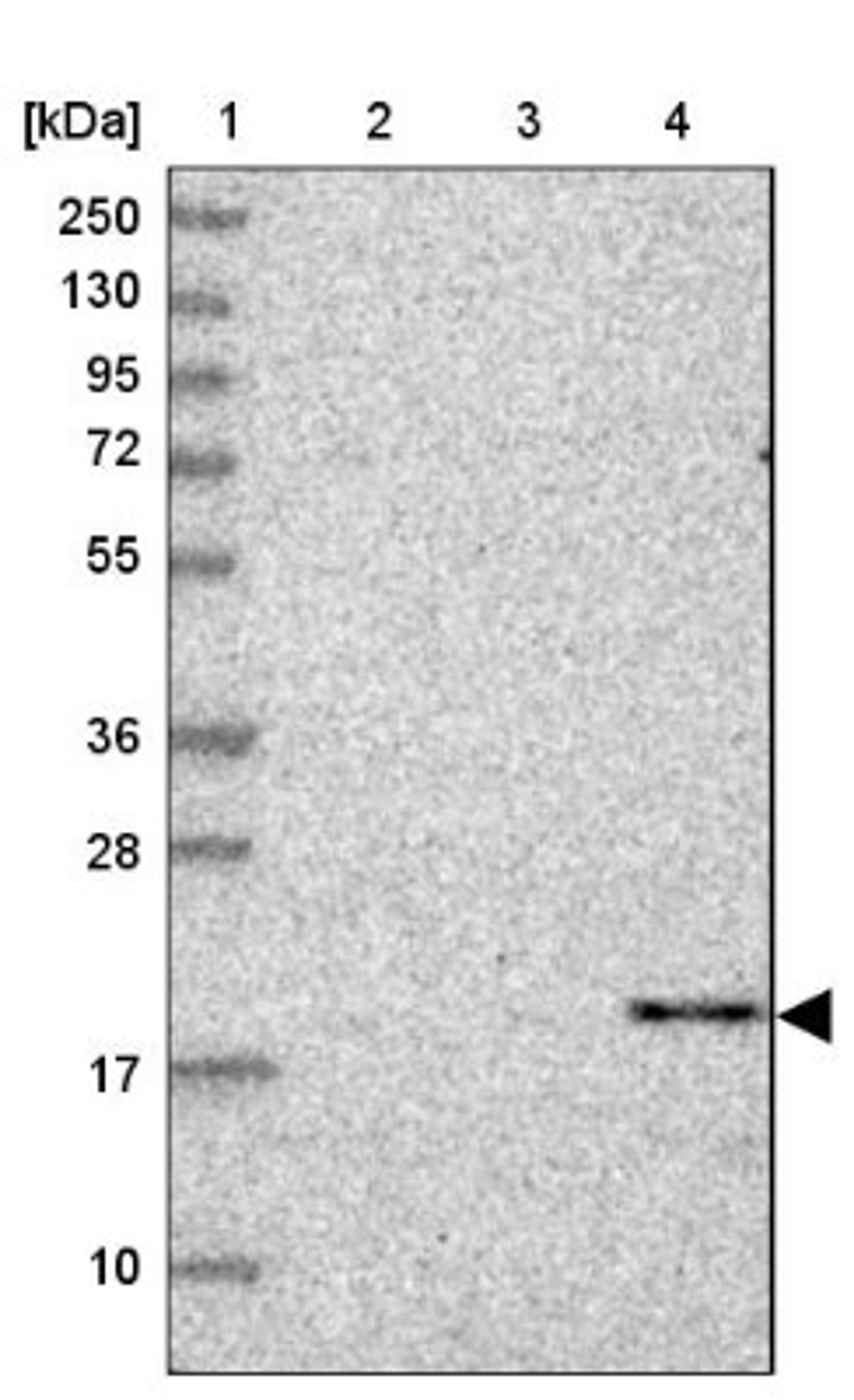 Western Blot: CBLN3 Antibody [NBP1-85844] - Lane 1: Marker [kDa] 250, 130, 95, 72, 55, 36, 28, 17, 10<br/>Lane 2: Human cell line RT-4<br/>Lane 3: Human cell line U-251MG sp<br/>Lane 4: Human plasma (IgG/HSA depleted)