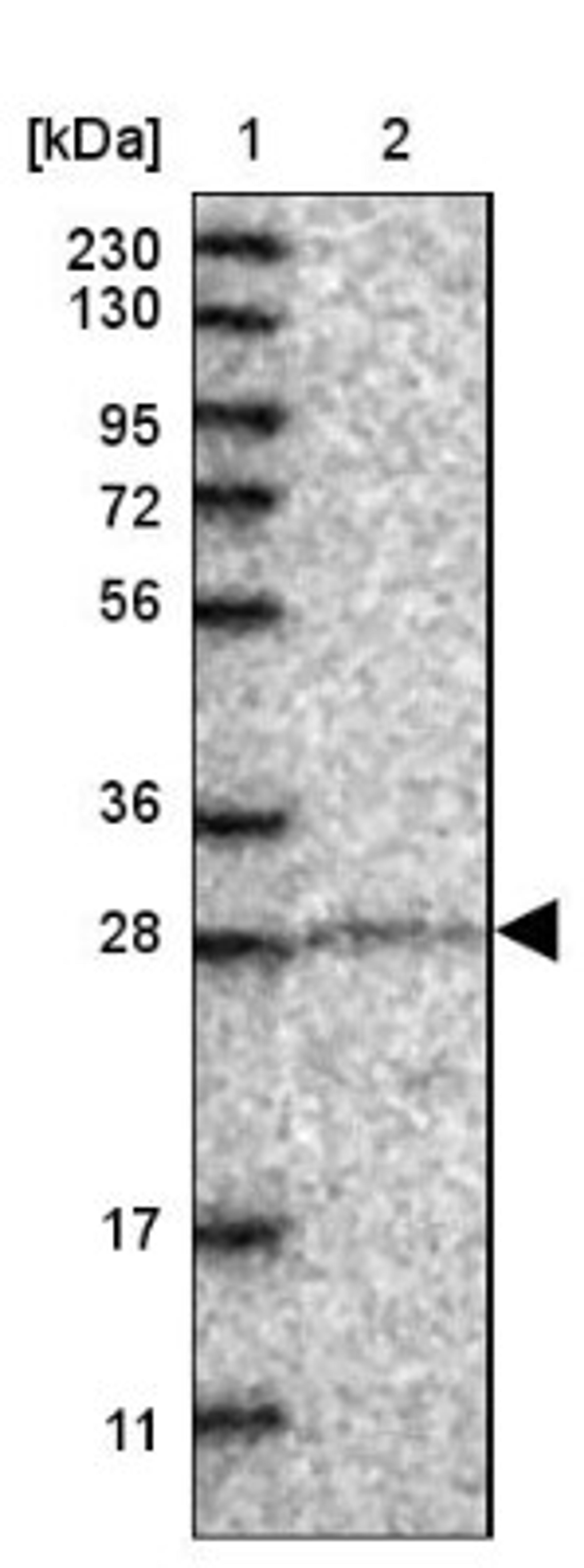 Western Blot: ZMYND19 Antibody [NBP1-81047] - Lane 1: Marker [kDa] 230, 130, 95, 72, 56, 36, 28, 17, 11<br/>Lane 2: Human cell line RT-4