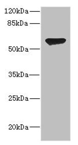 Western blot. All lanes: CHRNA2 antibody at 2.41µg/ml + HL60 whole cell lysate. Secondary. Goat polyclonal to rabbit IgG at 1/10000 dilution. Predicted band size: 60, 59 kDa. Observed band size: 60 kDa