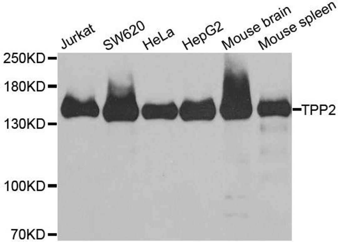 Western blot analysis of extracts of various cell lines using TPP2 antibody