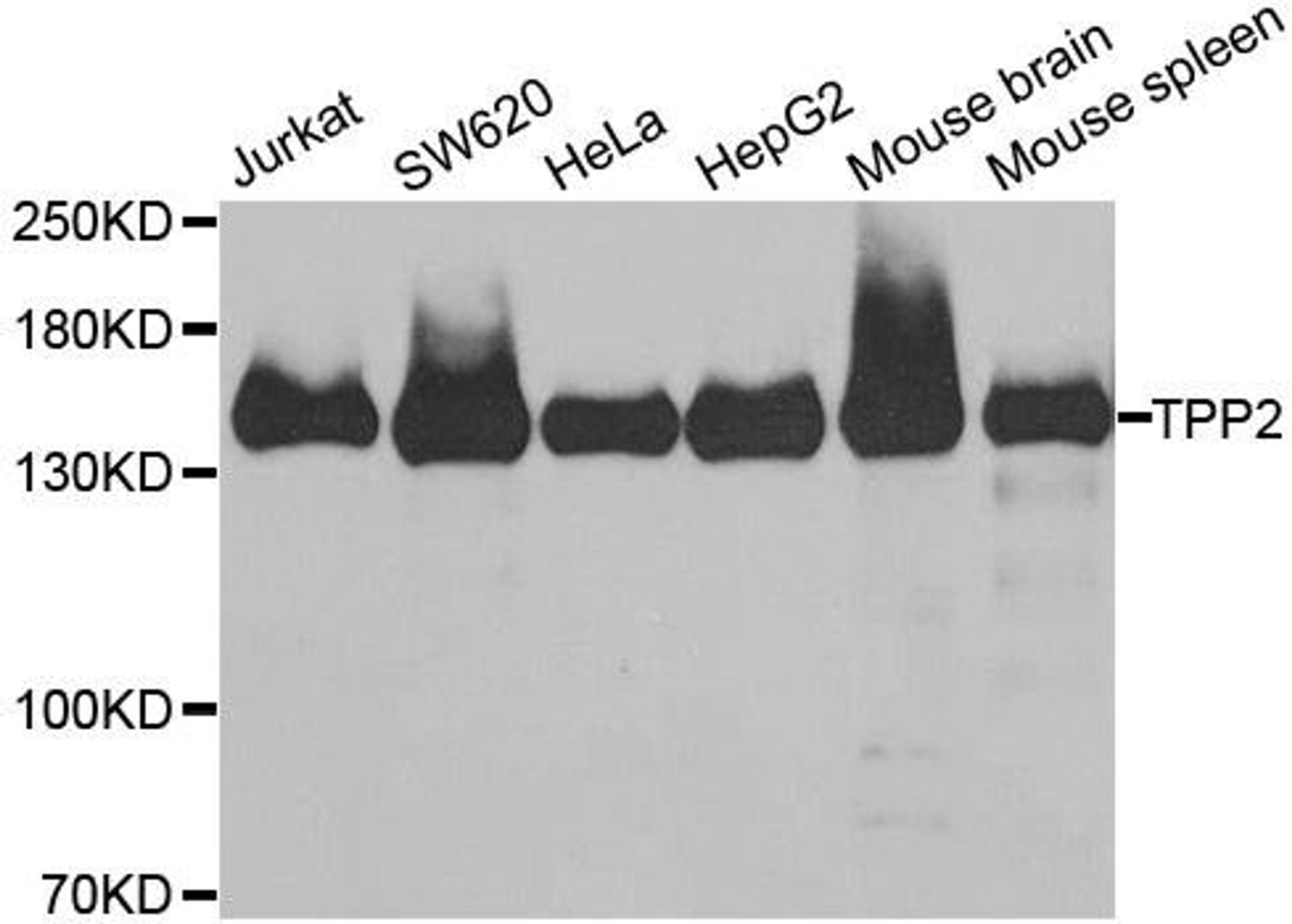 Western blot analysis of extracts of various cell lines using TPP2 antibody