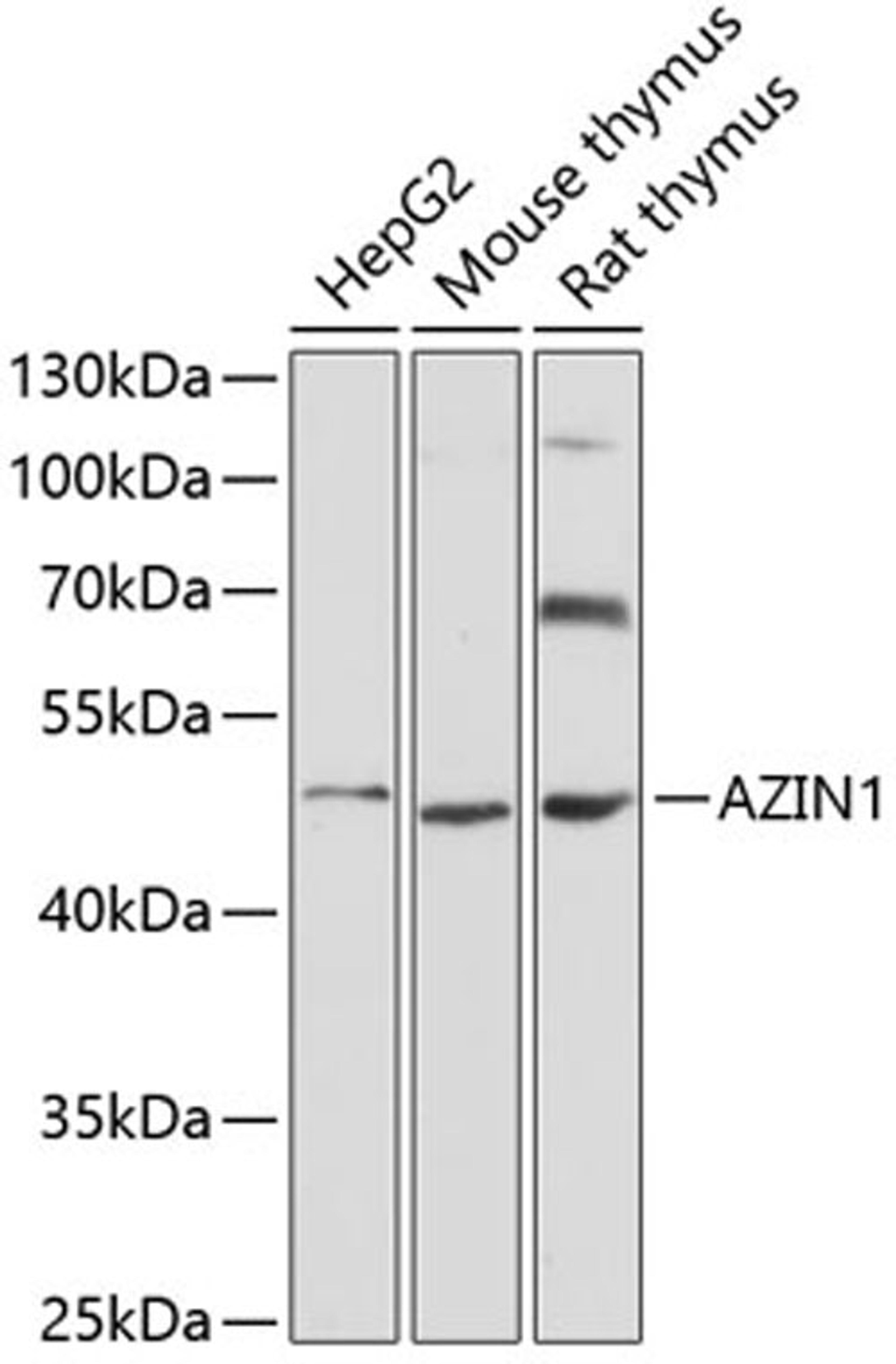 Western blot - AZIN1 antibody (A4747)