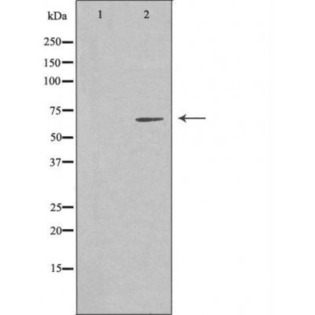 Western blot analysis of COLO cells using EME1 antibody