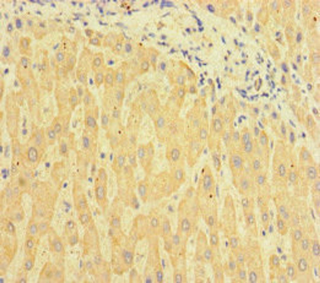 Immunohistochemistry of paraffin-embedded human liver tissue using CSB-PA713105HA01HU at dilution of 1:100