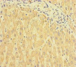 Immunohistochemistry of paraffin-embedded human liver tissue using CSB-PA713105HA01HU at dilution of 1:100