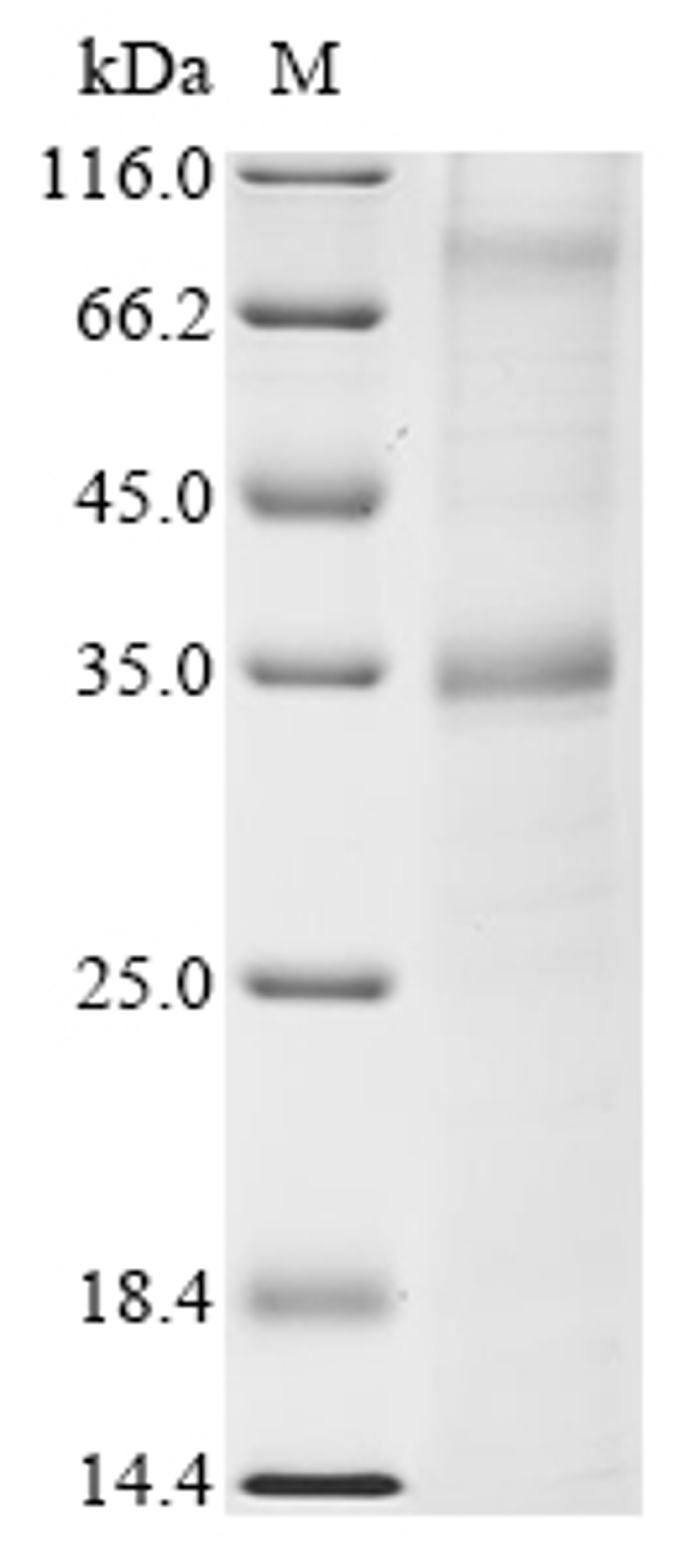 (Tris-Glycine gel) Discontinuous SDS-PAGE (reduced) with 5% enrichment gel and 15% separation gel.