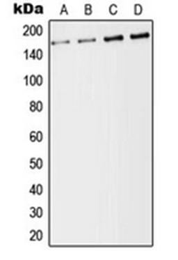 Western blot analysis of K562 (Lane 1), Raji (Lane 2), SP2/0 (Lane 3), H9C2 (Lane 4) whole cell lysates using ALK antibody