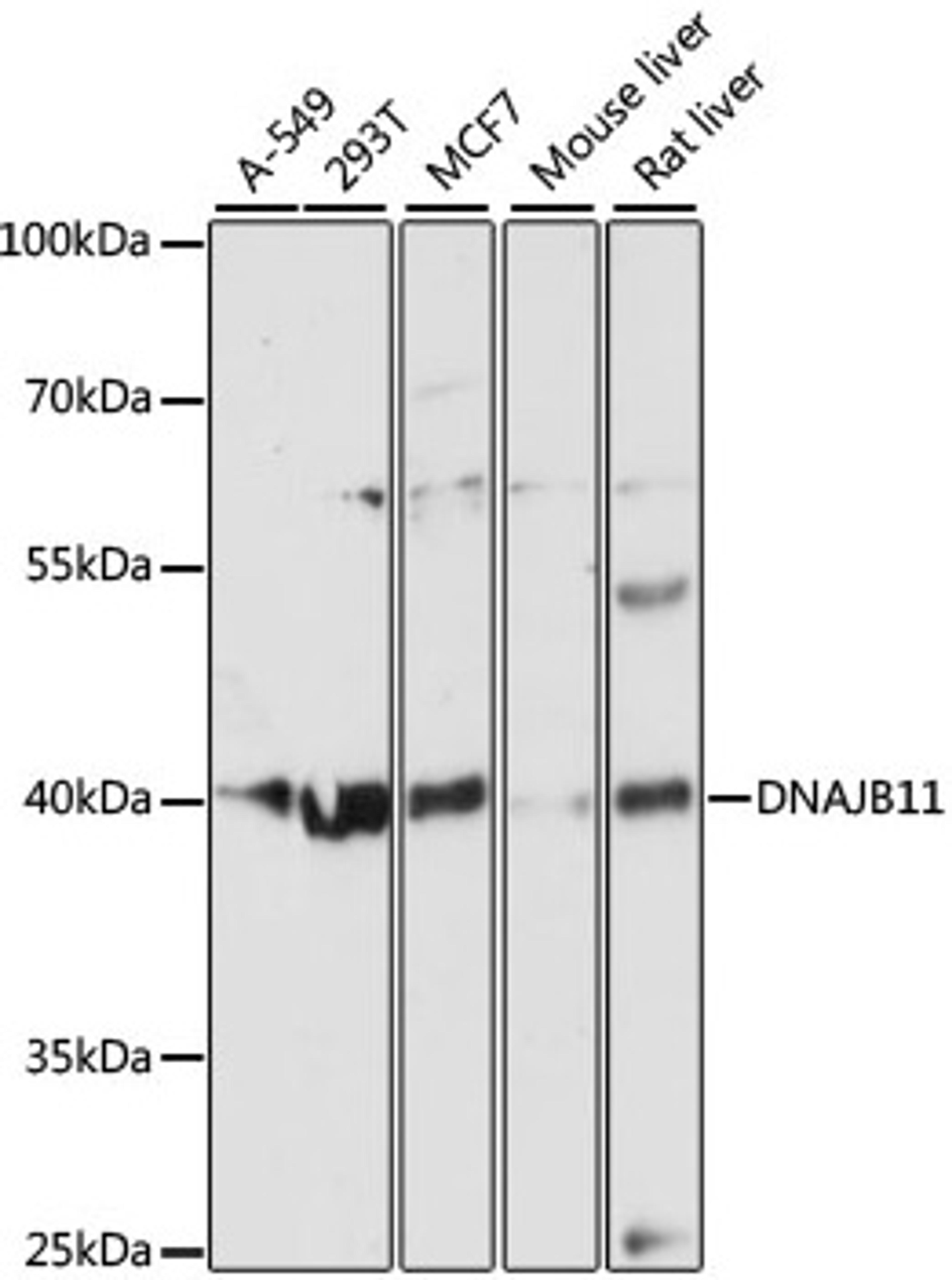 Western blot - DNAJB11 Polyclonal Antibody (A12915)