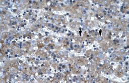 Immunohistochemistry-Paraffin: LHX6 Antibody [NB200-526] - Human Liver Tissue, antibody concentration 4-8ug/ml. Cells with positive label: Hepatocytes (indicated with arrows) 400X magnification.