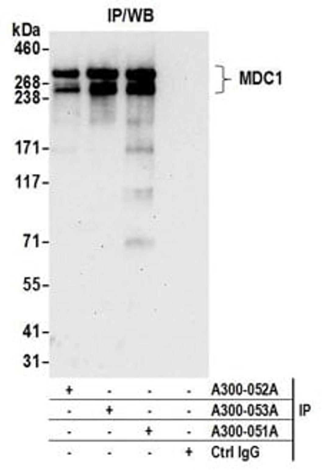 Detection of human MDC1 by western blot of immunoprecipitates.