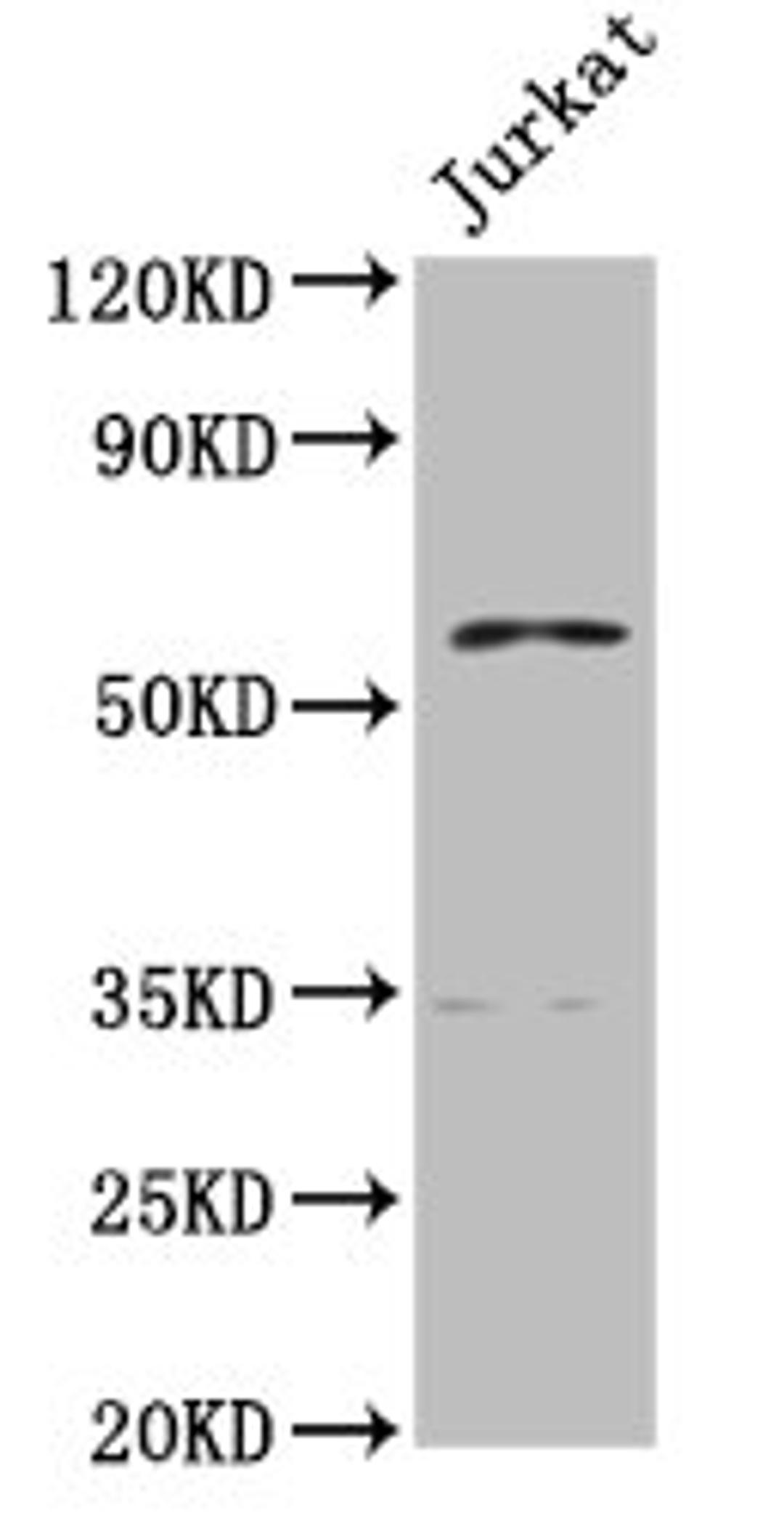 Western Blot. Positive WB detected in: Jurkat whole cell lysate. All lanes: PCCB antibody at 7.7µg/ml. Secondary. Goat polyclonal to rabbit IgG at 1/50000 dilution. Predicted band size: 59, 61 kDa. Observed band size: 59 kDa