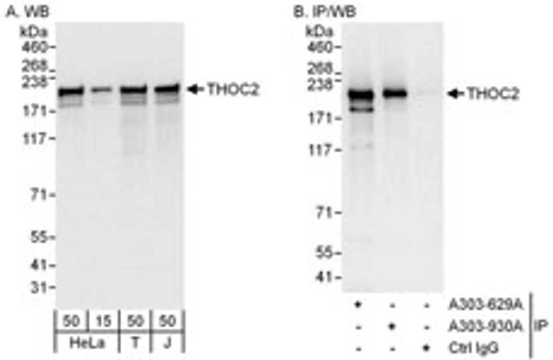 Detection of human THOC2 by western blot and immunoprecipitation.