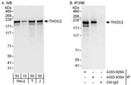 Detection of human THOC2 by western blot and immunoprecipitation.